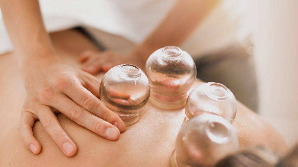 Acuhelp Treatments - Cupping