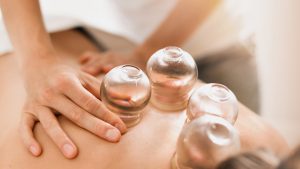 Introduction to Cupping Therapy