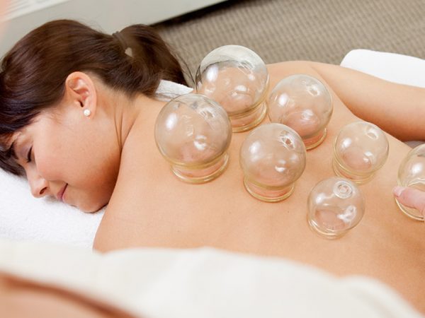 Cupping Therapy